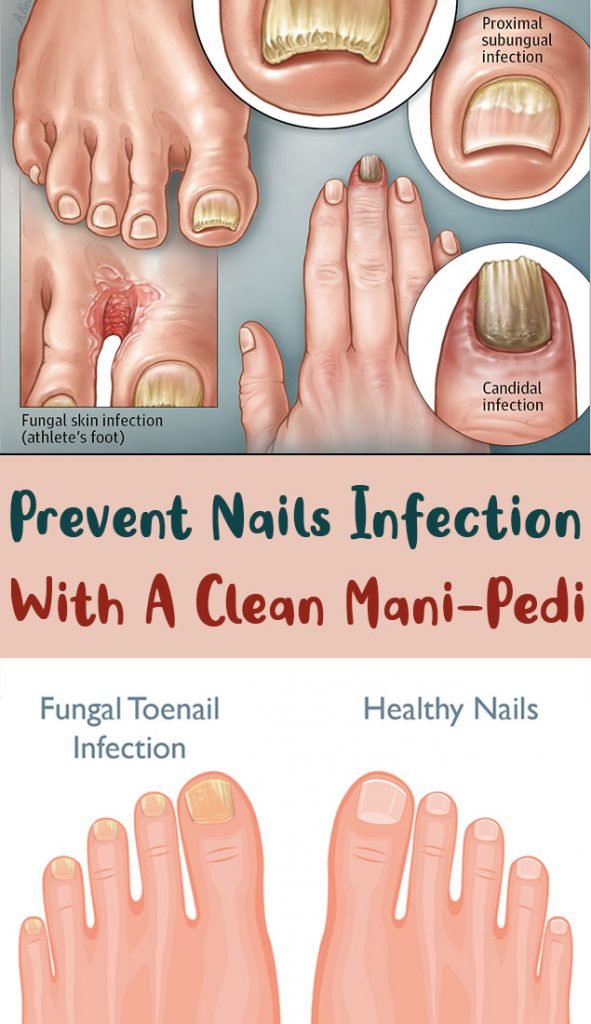 prevent-nails-infection-with-a-clean-mani-pedi-simple-tips-for-you