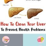 How To Clean Your Liver To Prevent Health Problems