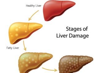 How To Clean Your Liver To Prevent Health Problems