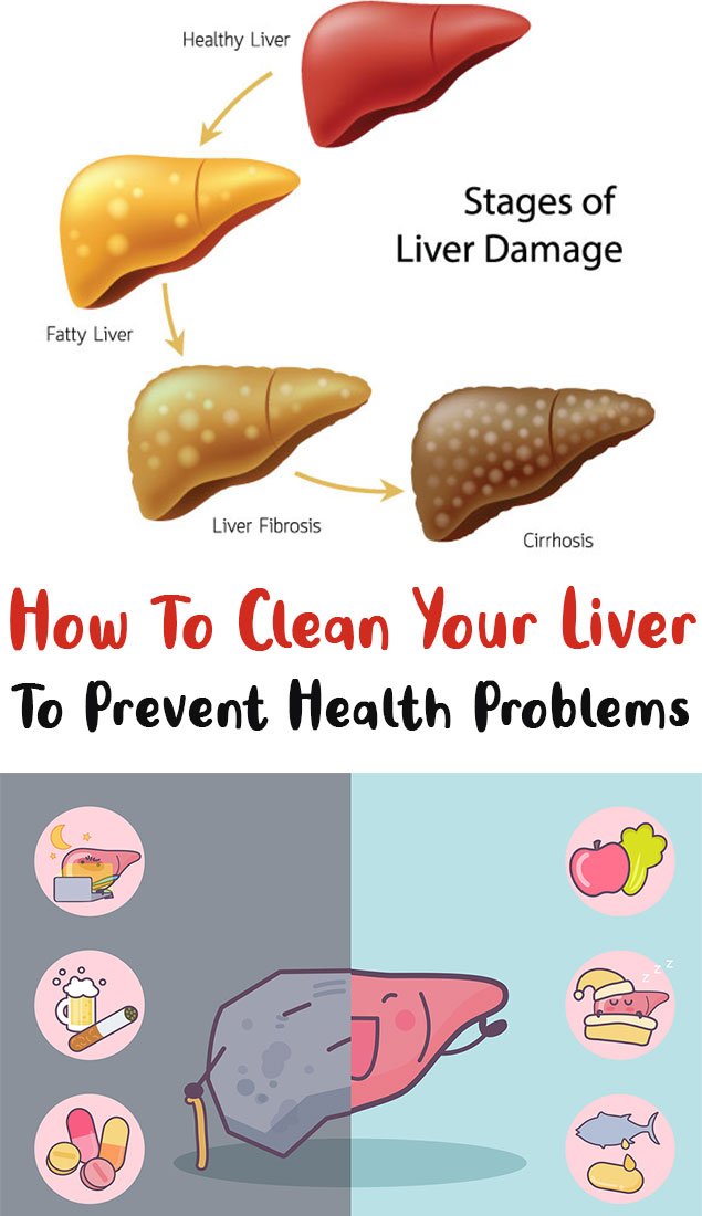 How To Clean Your Liver To Prevent Health Problems - Simple Tips for You