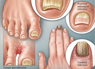Prevent Nails Infection With A Clean Mani-Pedi