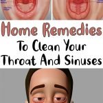 Home Remedies To Clean Your Throat And Sinuses